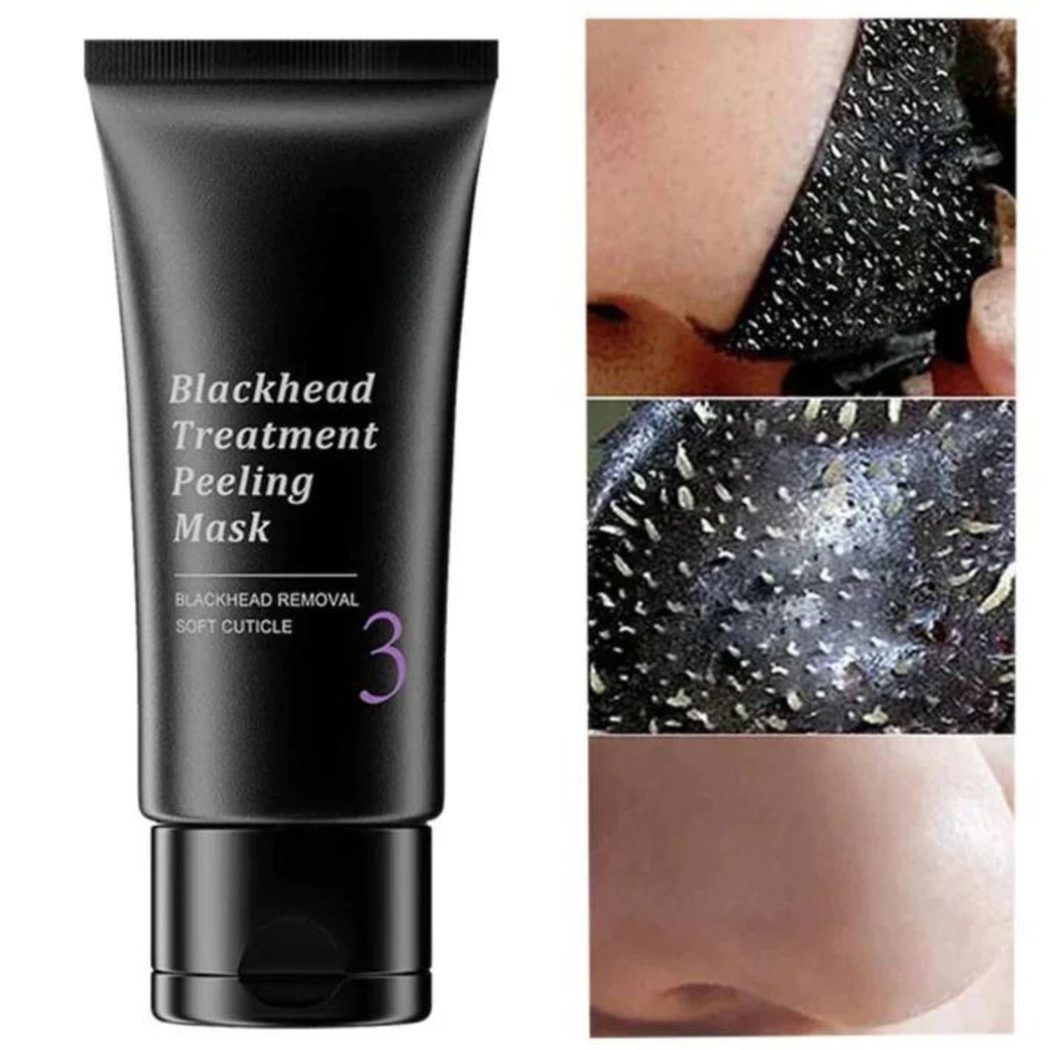 Blackhead Peeling Mask