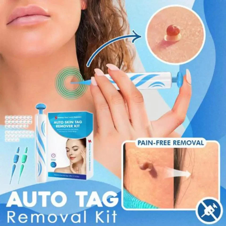 Auto tag removal kit - remove skin tags