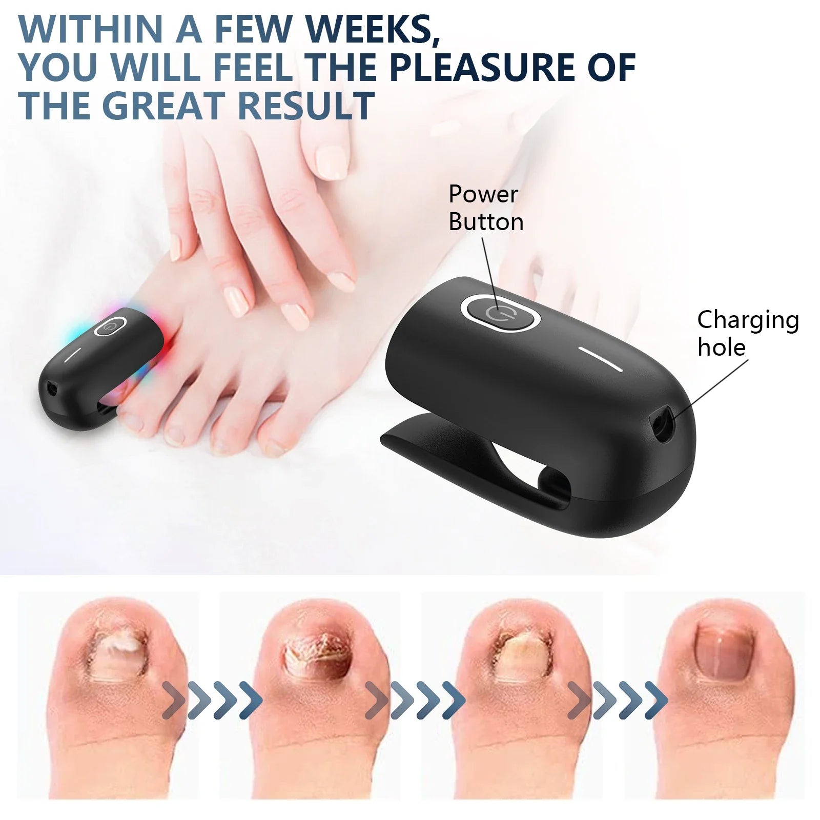 De antischimmel-lasertherapiemachine voor teennagels met USB-oplader