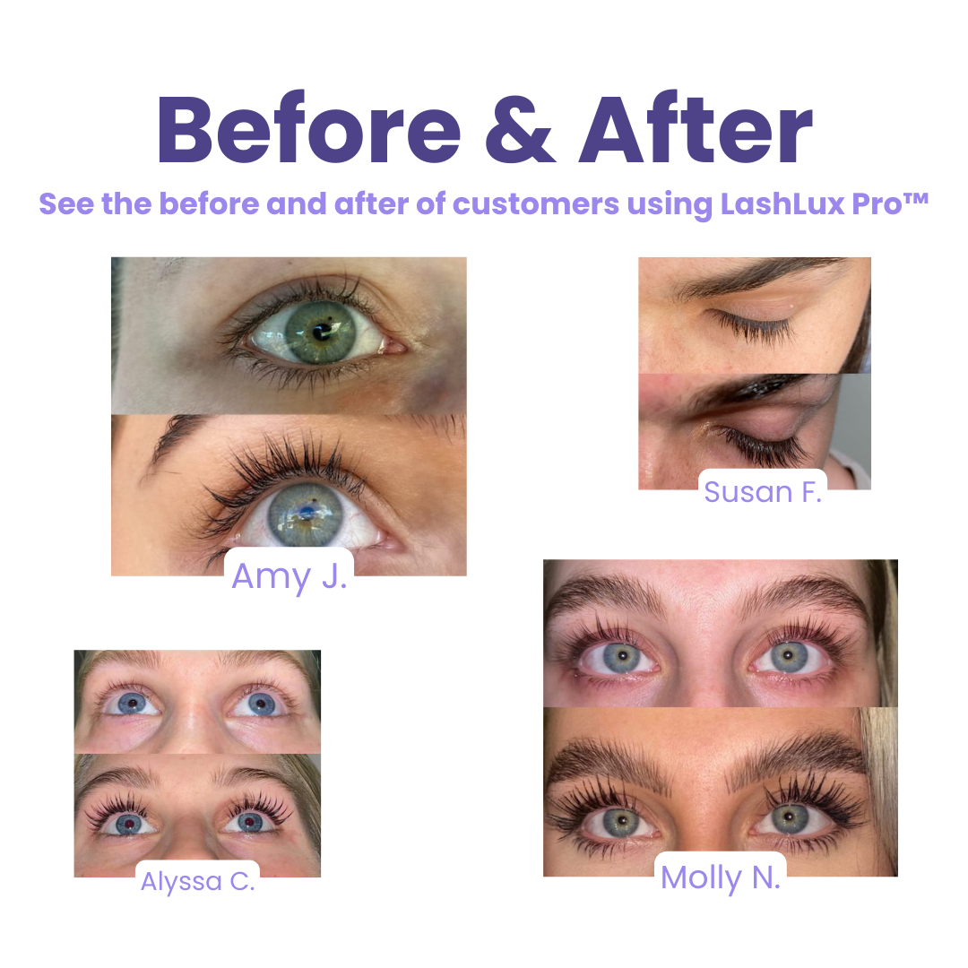 LashLux Pro™ - Suero para el crecimiento de las pestañas