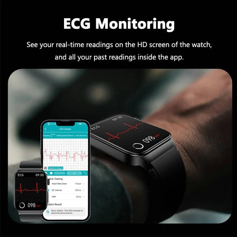 Smartwatch per il monitoraggio della salute tutto-in-uno con ECG e misuratore di glucosio nel sangue