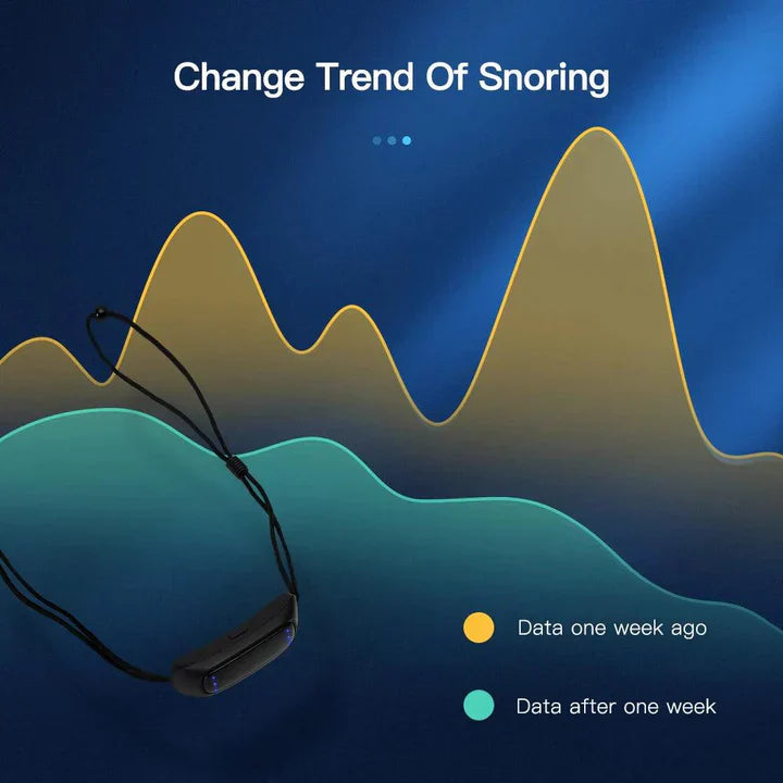 Smart Anti Snarkning Device EMS Puls Stop Snore Bärbar Bekväm Sov Bra Stoppa Snark Hälsovård Sömnapnéhjälp USB